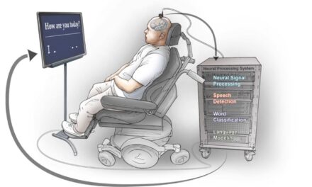 Νευροπροσθετική συσκευή «διαβάζει» τον εγκέφαλο και ξαναδίνει «φωνή» σε άνθρωπο με παράλυση ομιλίας